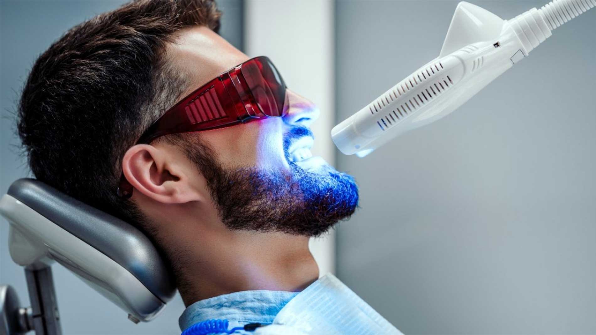 Sbiancamento Denti Con Lampada Led Che Attiva Il Gel Sbiancante Per Denti