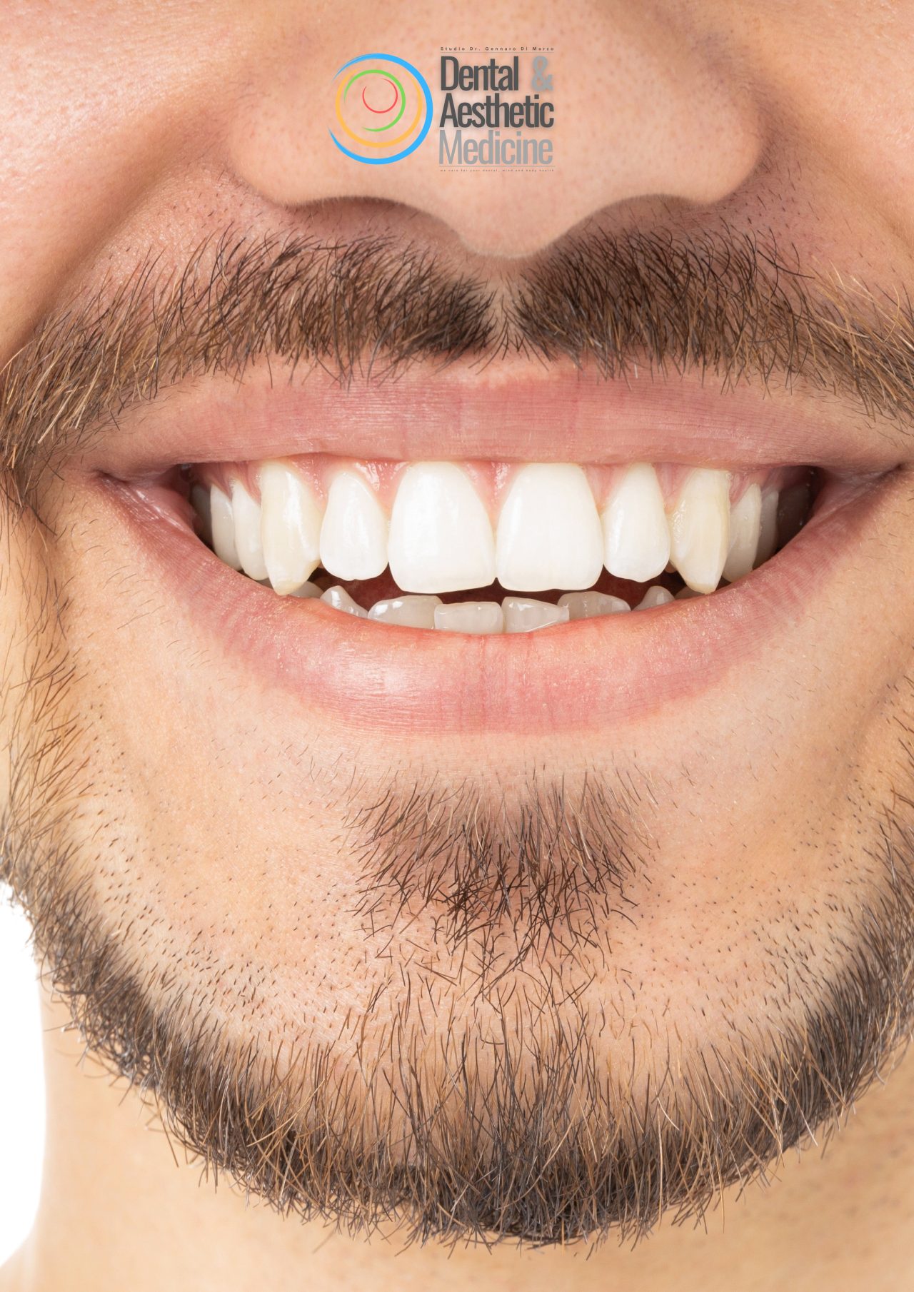 Parodontite Dentisti A Firenze 1