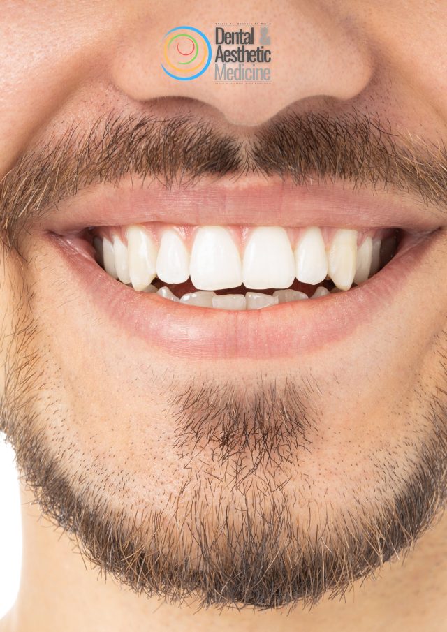 Parodontite Dentisti A Firenze 1