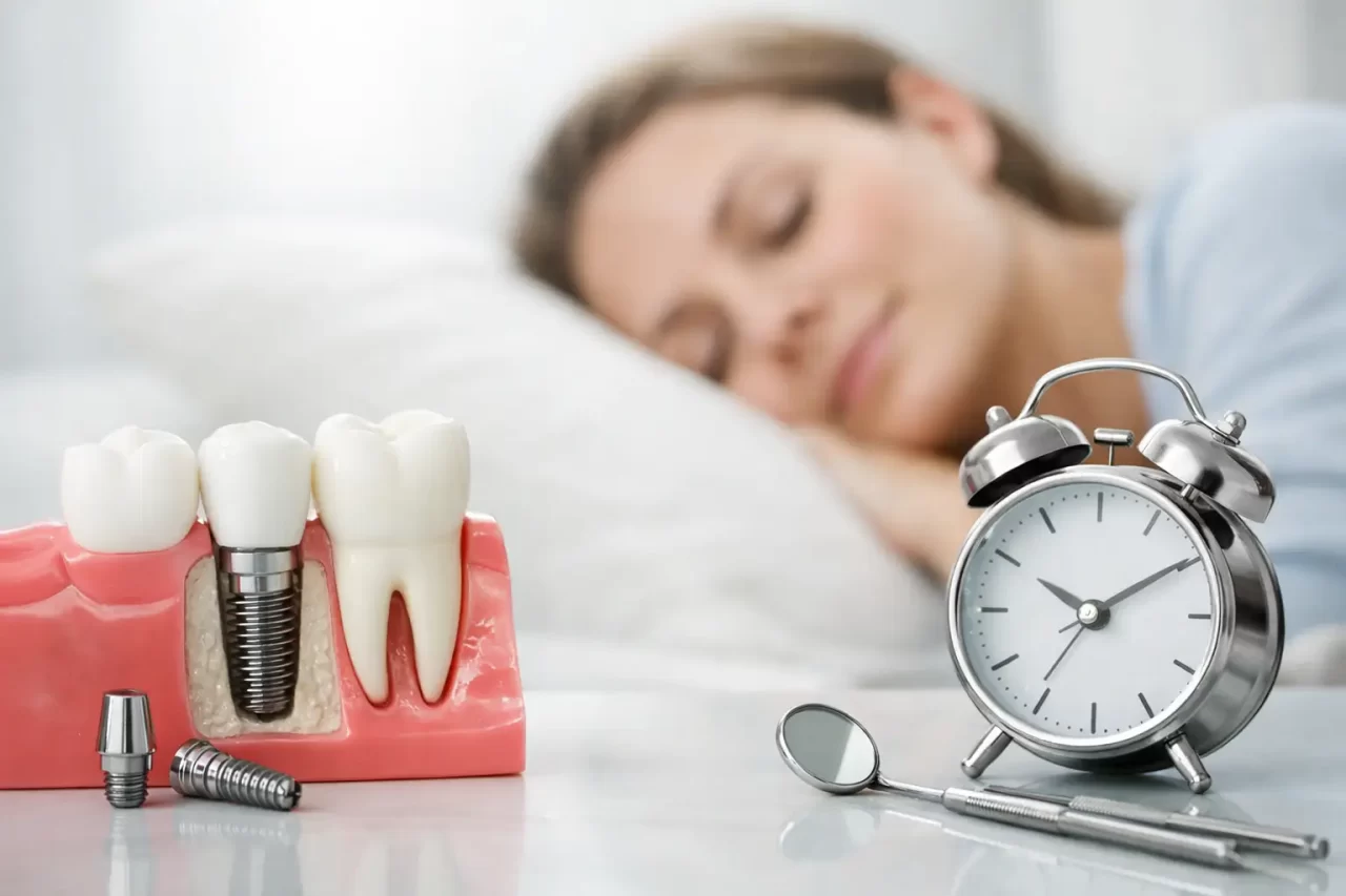 Tempi di recupero dopo impianto dentale